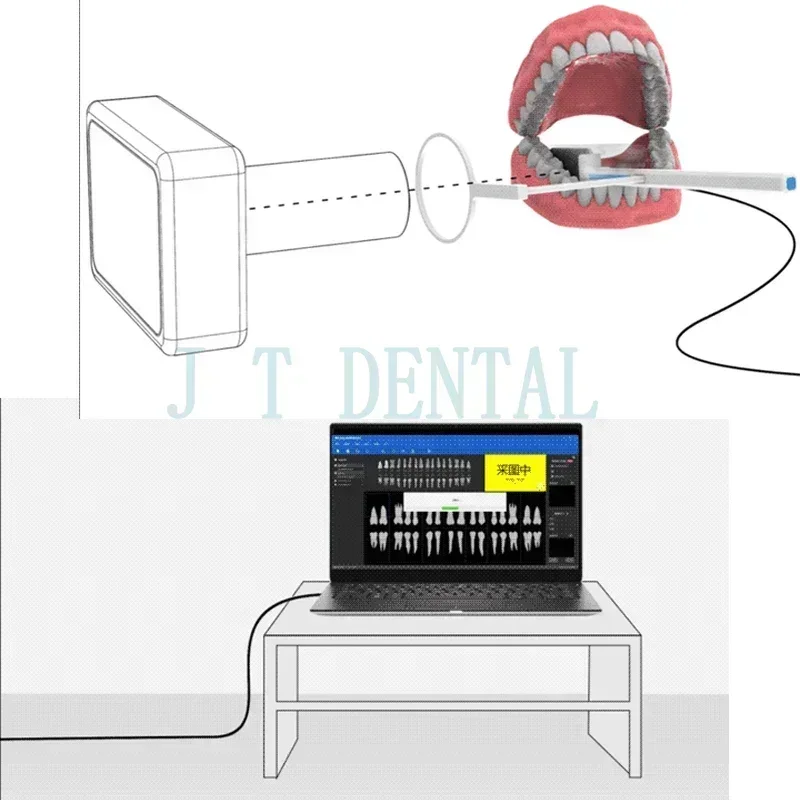 

The latest technology portable digital X-ray sensor no consumables drop-proof waterproof suitable for dentistry and pets