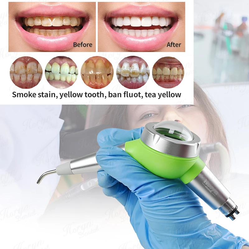 Colorful Dental Air Water Polisher Jet Air Flow Oral hygiene Tooth Cleaning Prophy Polishing gun Dental equipment