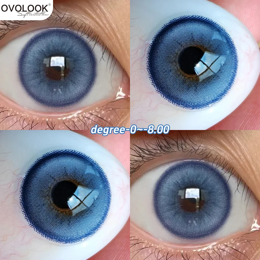 Category image: Contact Lenses