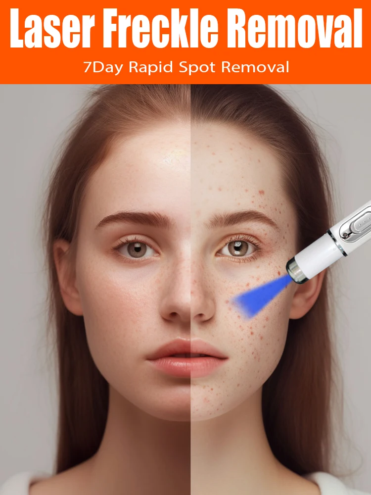 

Fast laser repair of facial spots