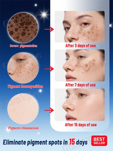 Imagen 2 del producto Proporcionar experiencia cómoda, herramientas de cuidado con puntero láser.