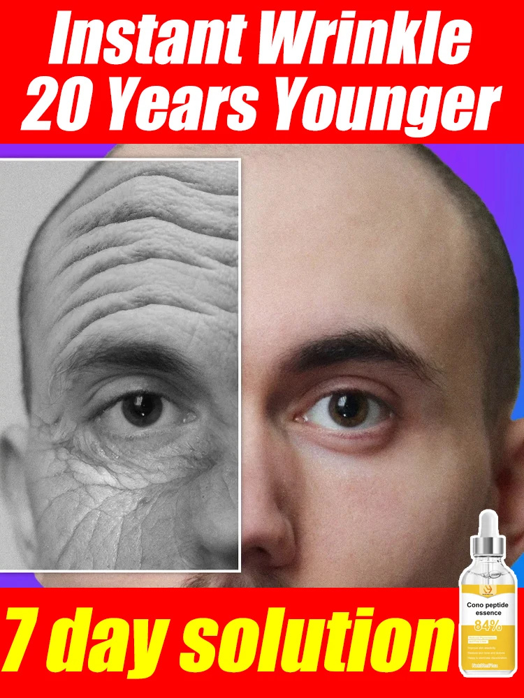 

НЕТ морщин, 20-летний младший