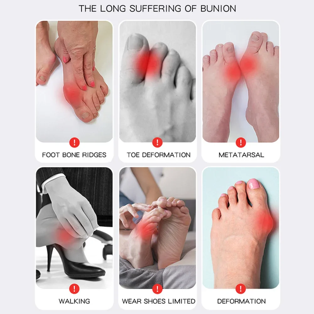 Big Toe Bunion Corrector Adjustable Orthopedic Socks Toes Separator Pain Relief Hallux Valgus Feet Protector Foot Care Tools