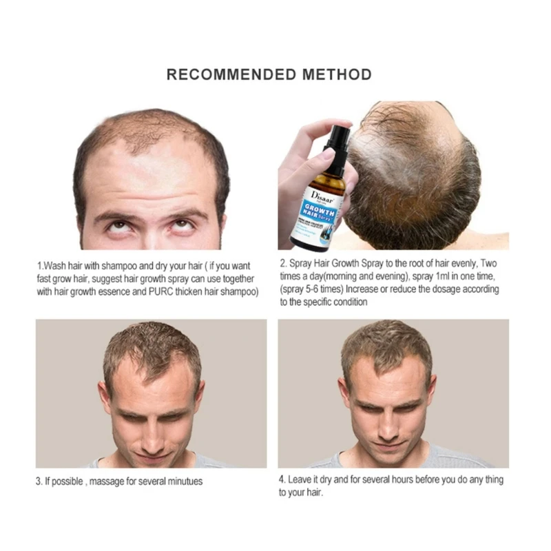 Traitement sérum d'huile croissance cheveux pour perte cheveux l'amincissement repousse des cheveux