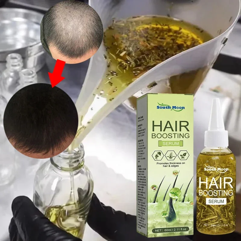 Fast Hair Growth Oil Anti Hair Loss Serum Africa Crazy Traction Alopecia Treatment Scalp Break Hair Strengthener Care Products