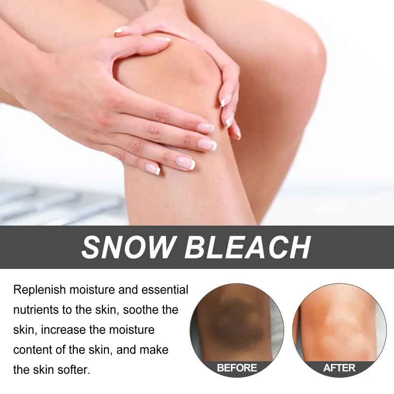 Snow Bleach Cream Moisturizing Brightening Underarm Black Spots Lightening Dark Intimate Parts Whitening Joint Melanin Cream