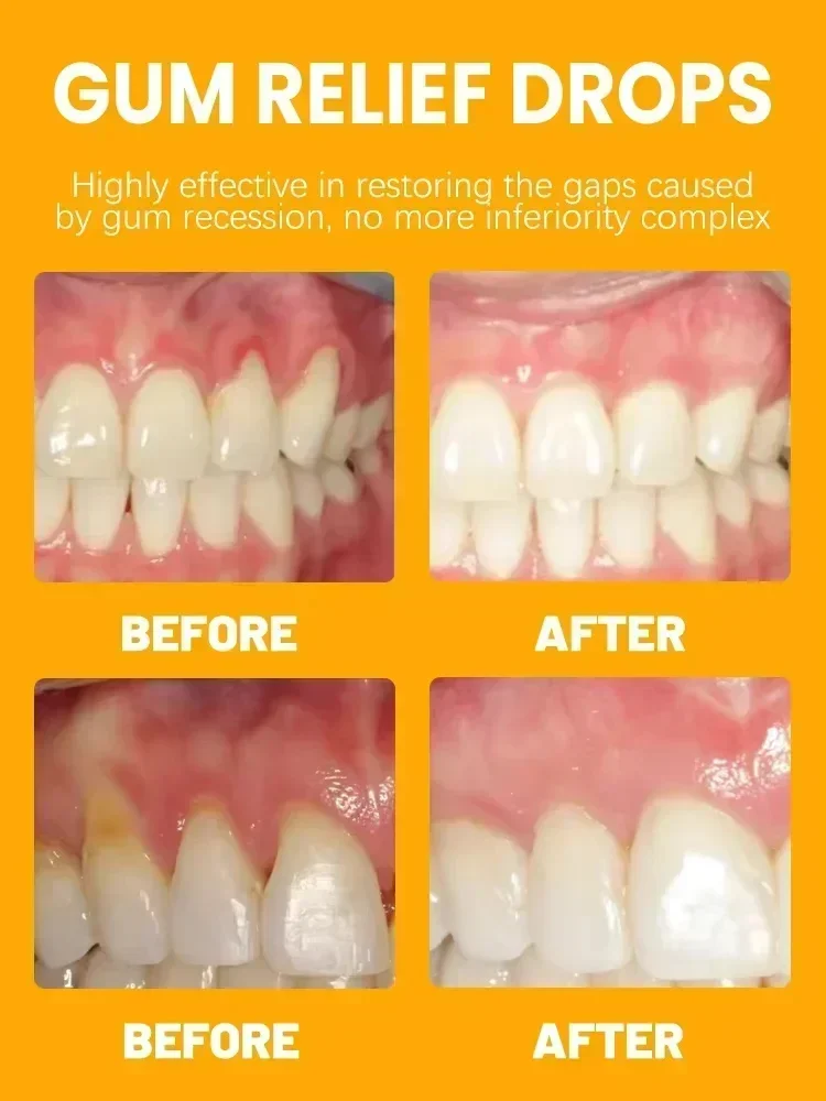 Effectively repair damaged gums, relieve toothache, strengthen teeth and strengthen gums