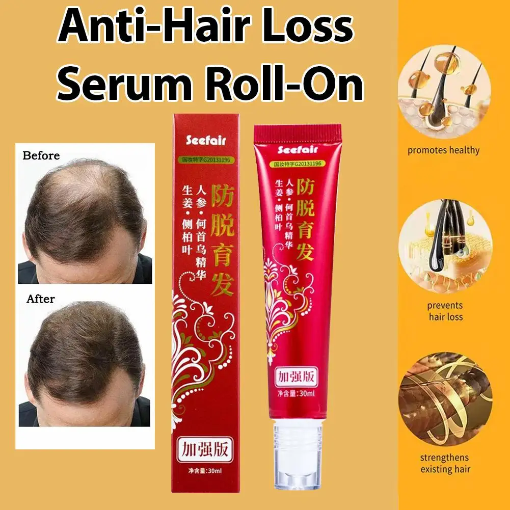 تدليك الأسطوانة Platycladus Orientalis مكافحة تساقط الشعر بوليغونوم متعدد الأزهار الزنجبيل السائل الأسطوانة فروة الرأس الشعر السائل V5M6 #1