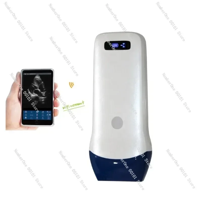 Linear Probe 3D 4D Color Doppler Ultrasonido Machine Wireless Wifi Portable Ultrasound Scanner