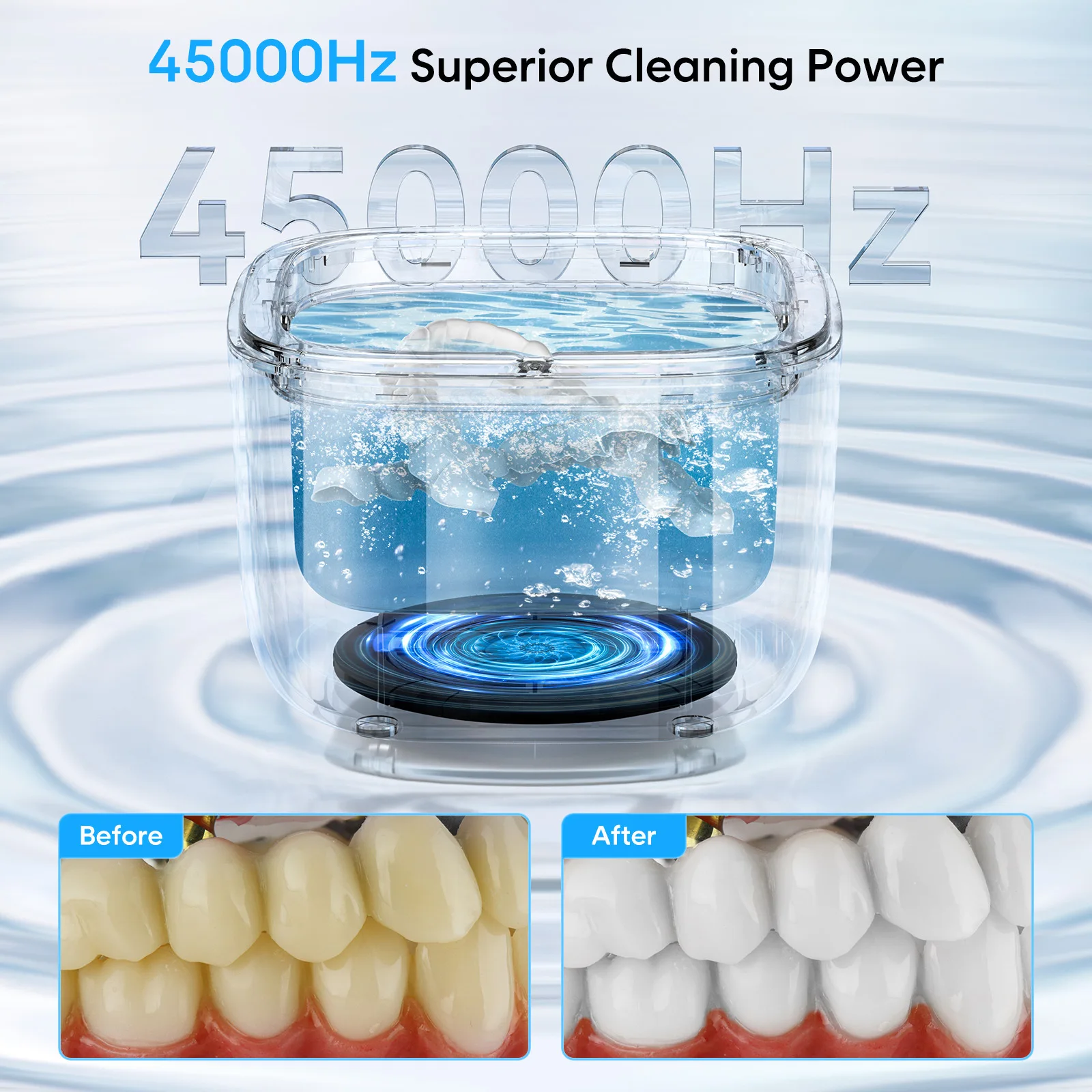 Professional Ultrasonic Cleaner for Invisible Braces, Dentures, Watches, Retainers, and Glasses