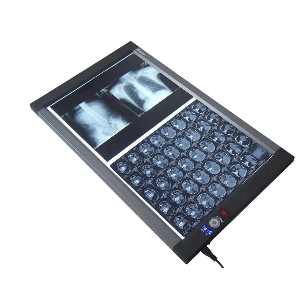 Adjustable Medical LED X Ray Imaging Film Viewer view box xray viewer Double panel led negatoscope  negatoscope x ray