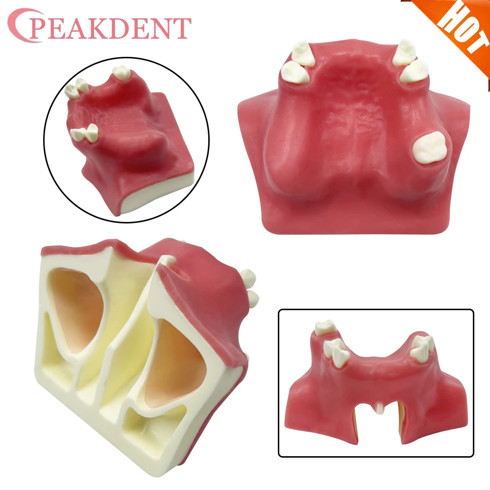 

1 шт., модель зубов верхнейщелевой пазухи, зубной имплантат, студенческая обучающая модель для практики, верхняя челюсть, имплантаты для подъема пазухи, модель реставрации