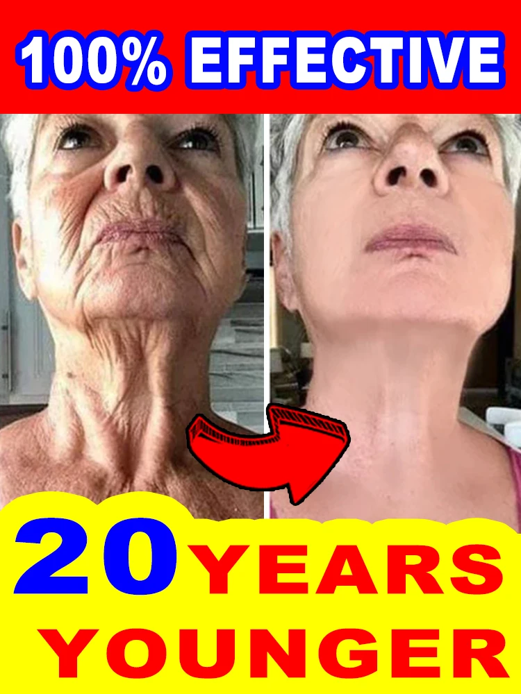 TODAS As Rugas desaparecem, 20 anos mais jovens.