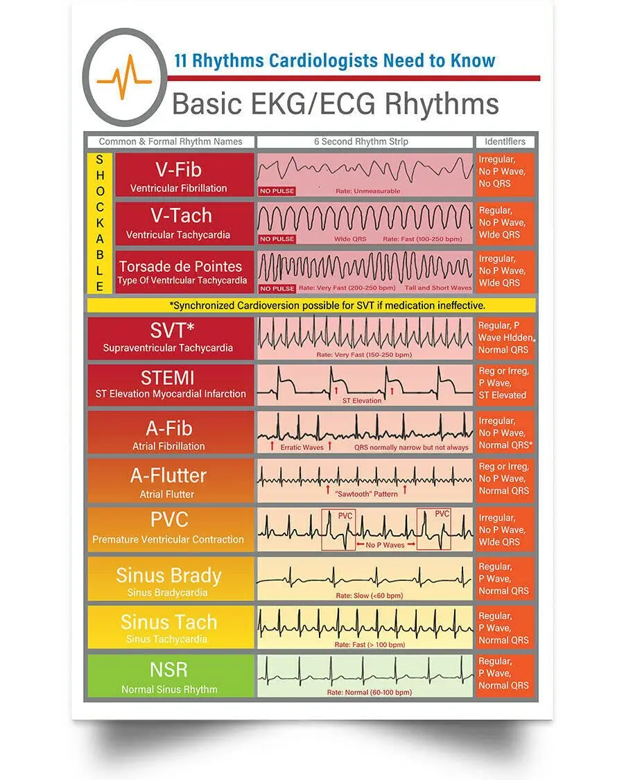 Basic EKG-ECG rhythms Knowledge Vertical Wall Art Print Poster Vintage Metal Tin Signs Poster Plaque for School Education Bar Ca