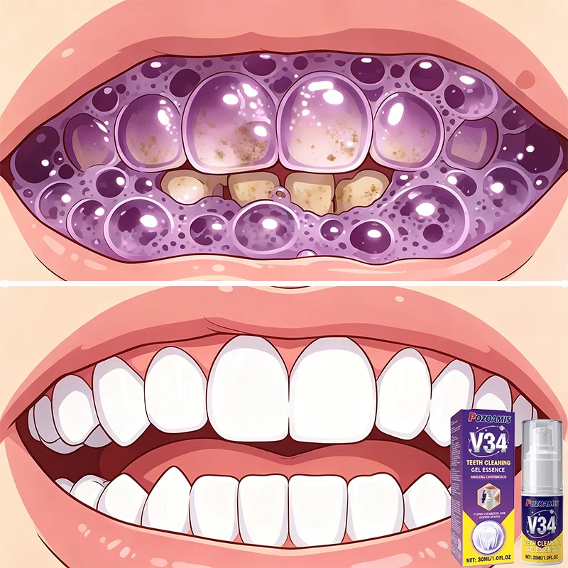 Professional brightening and refreshing ᴛᴏᴏᴛʜᴘᴀsᴛᴇ; repairs the root cause of cavities and strengthens teeth.