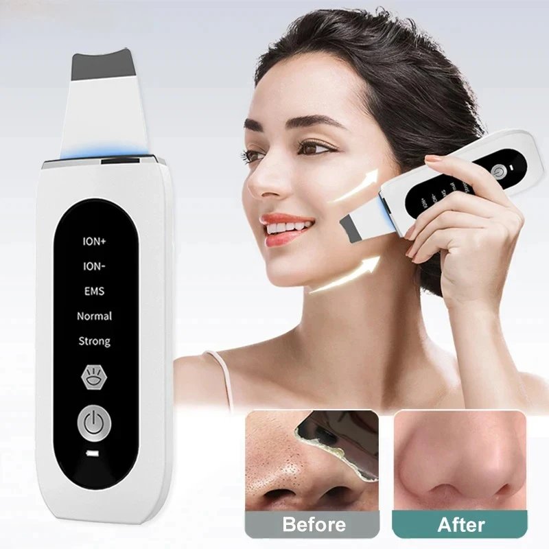 New ultrasonic skin scraper, household pore cleaner, colored light EMS blackhead shovel beauty