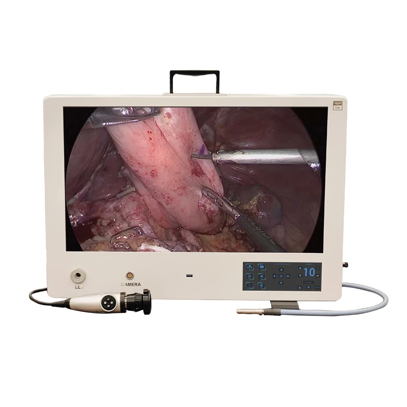 19/22/24inch ENT anti-moiree Portable 1080p HD 4 in 1 Endoscope camera for rigid flexible endoscope