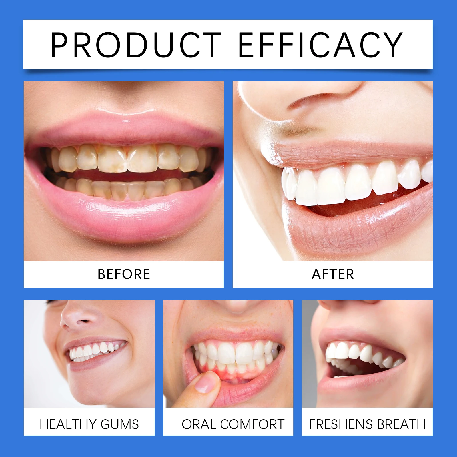 Teeth Whitening Spray to Improve Gum Health,Repair Tooth Whiten Teeth and Fresh Breath.Dry Mouth Treatment Oral Care Spray