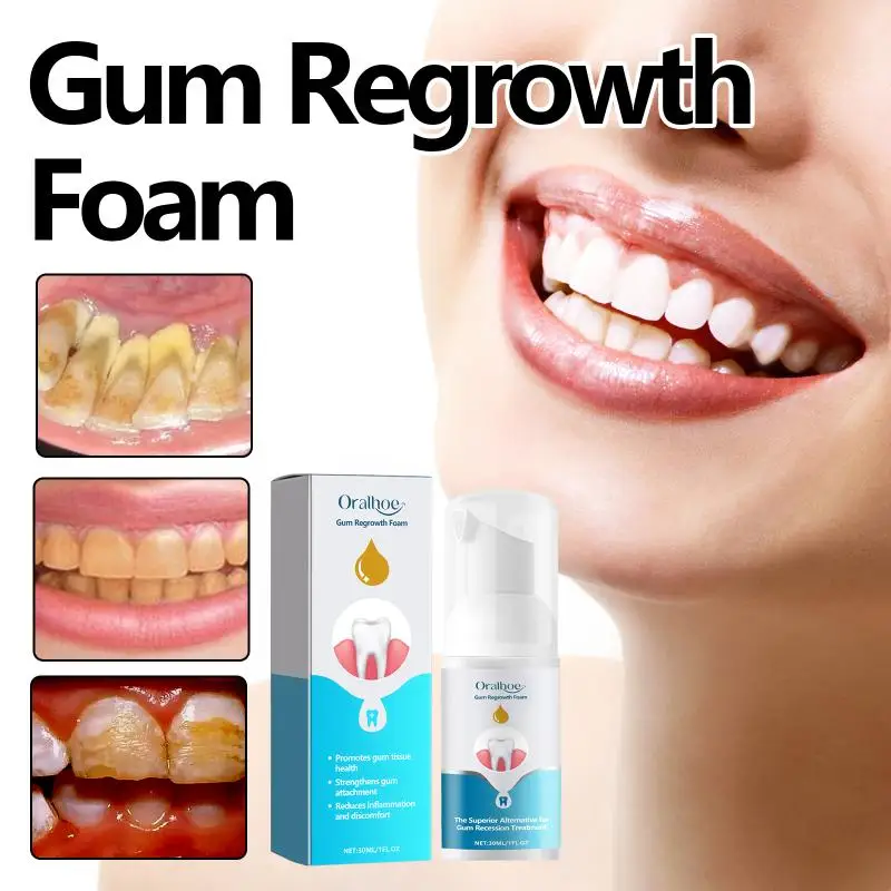 Gum Care Tooth Cleaning Foam Mousse Removes Plaque Tartar Prevents Cavities Freshens Breath for Daily Dental Use