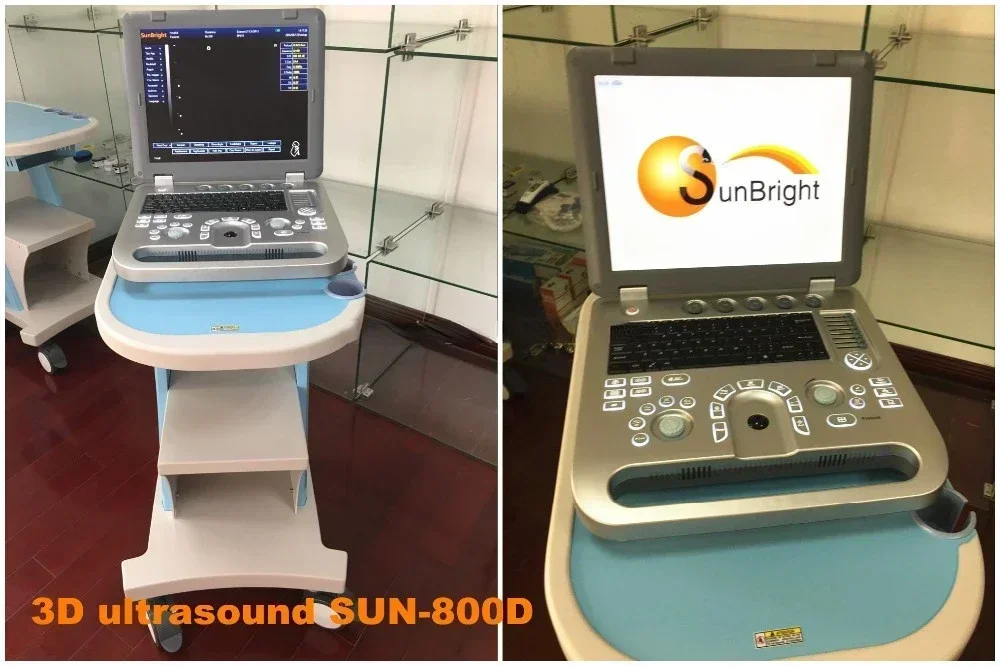 Cheapest price Laptop Digital 15 inch 2D 3D 4D obstetric gynecology ultrasound medical scanner