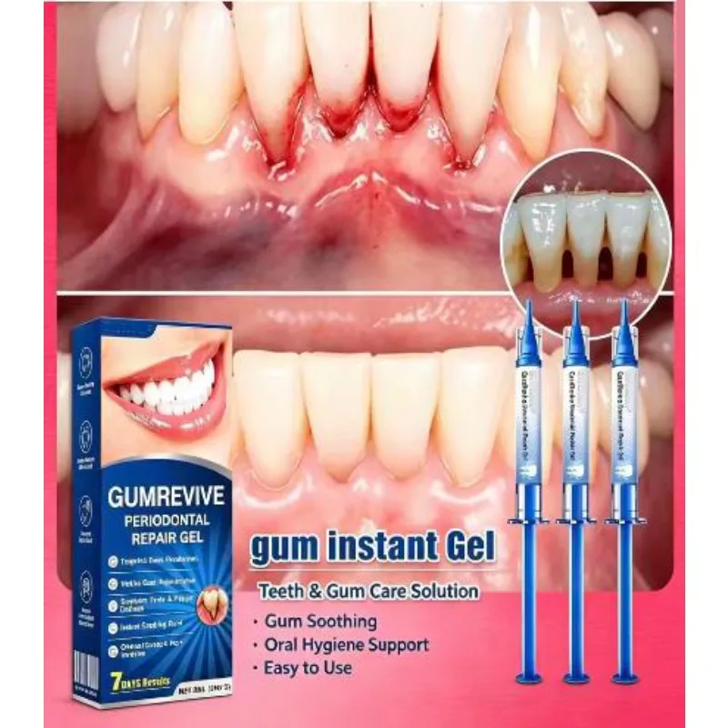 Teeth & Gum Care Gel Powerful Oral Fresh Care Formula Deep Cleaning Protection for Healthy Smile