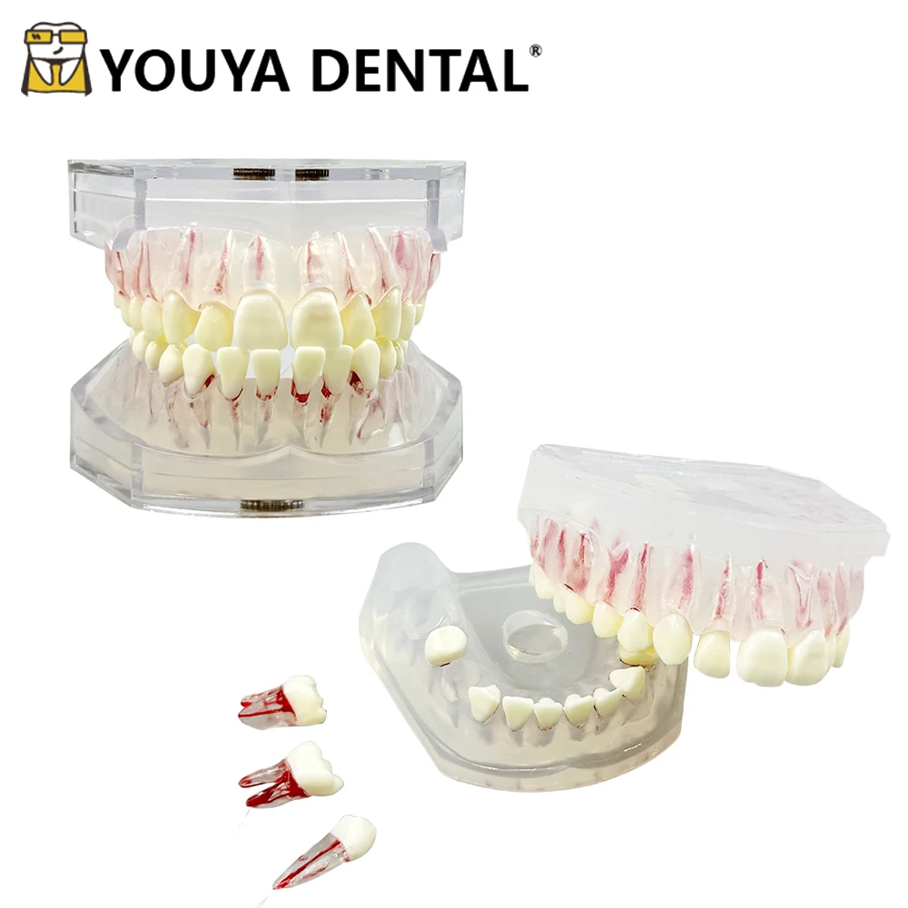 

Teeth Teaching Model Removable with Endodontic Root Canal Soft Gum Dental ModelFor Dentistry Practice Training Studying Typodont