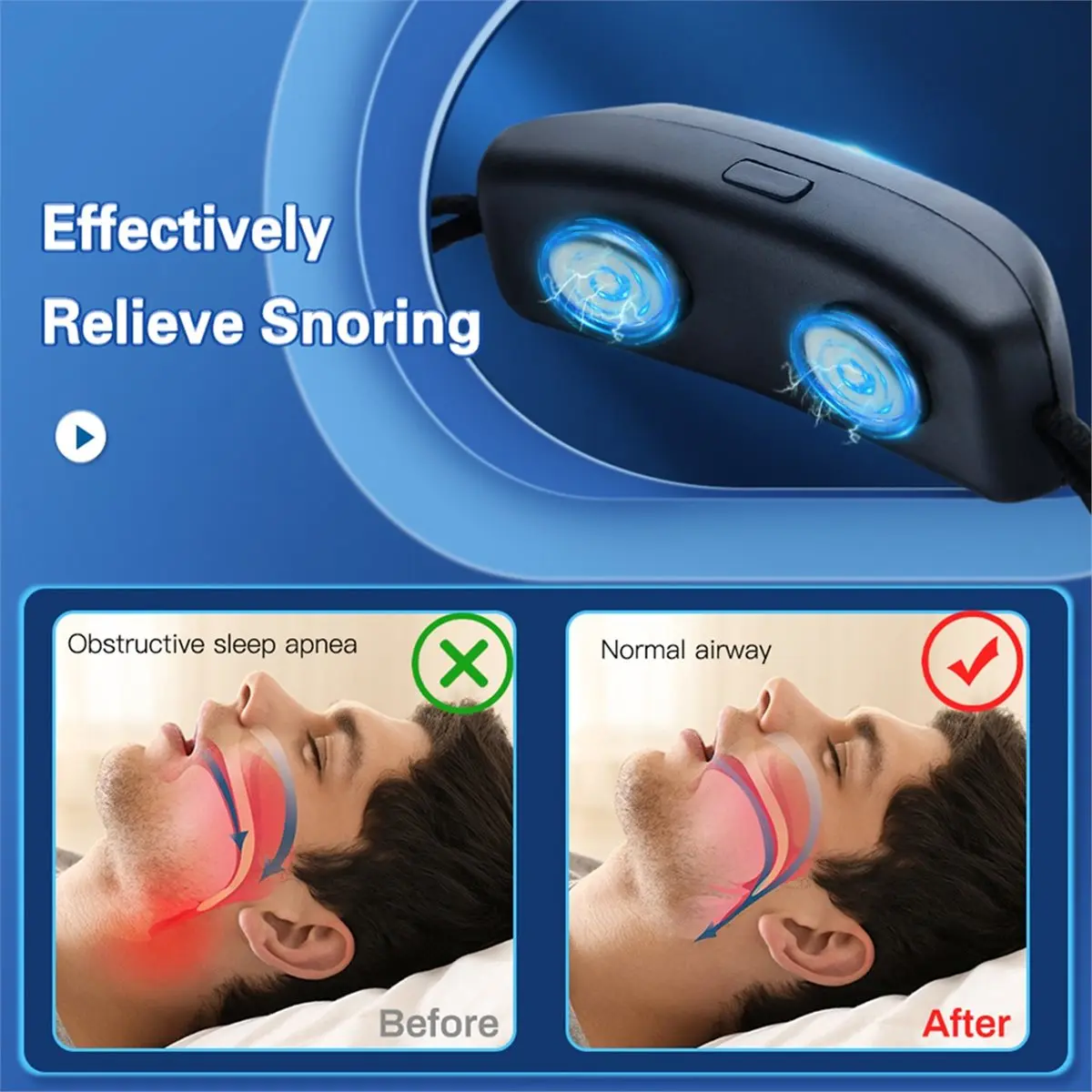 2026 Trend EMS Pulse Stop Snore Portable Comfortable Sleep Well Stop Snore Health Care Sleep USB Smart Anti Snoring Device
