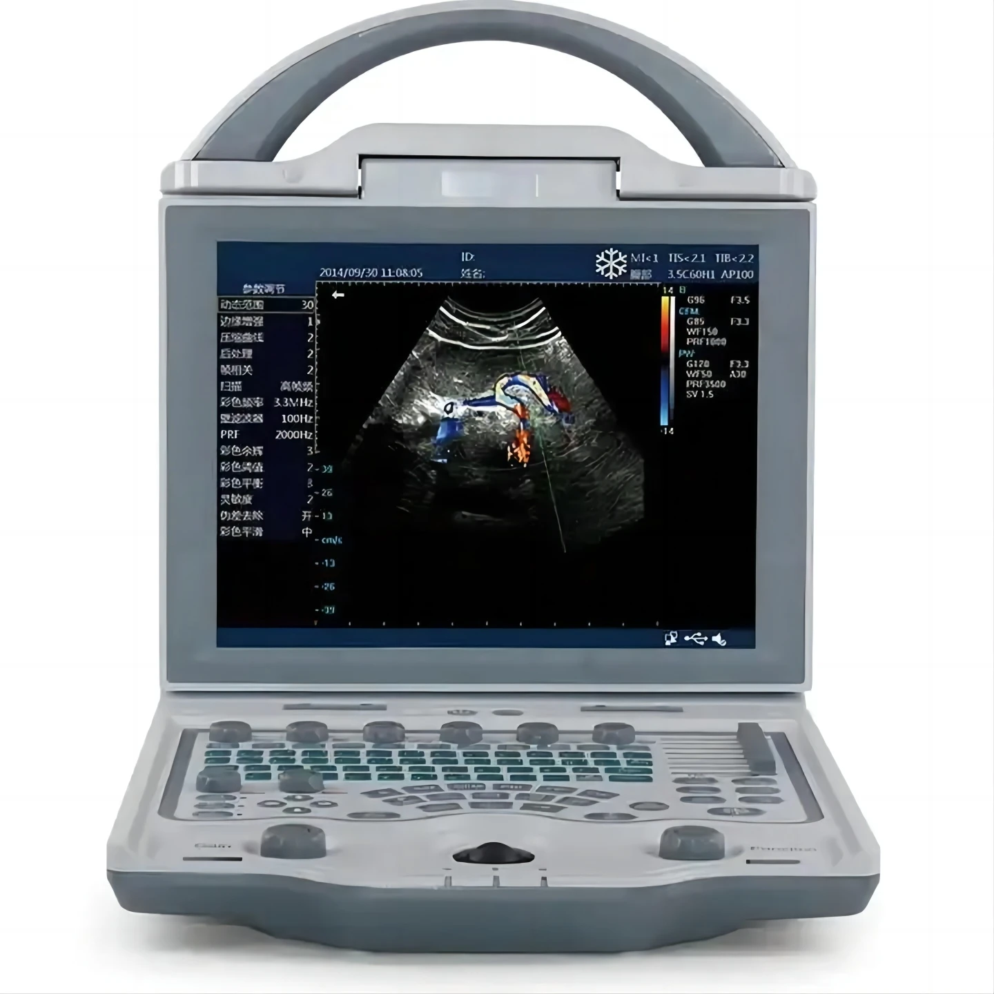 Low Price Sonosite Ultrasound Machine Ultrasound Scan