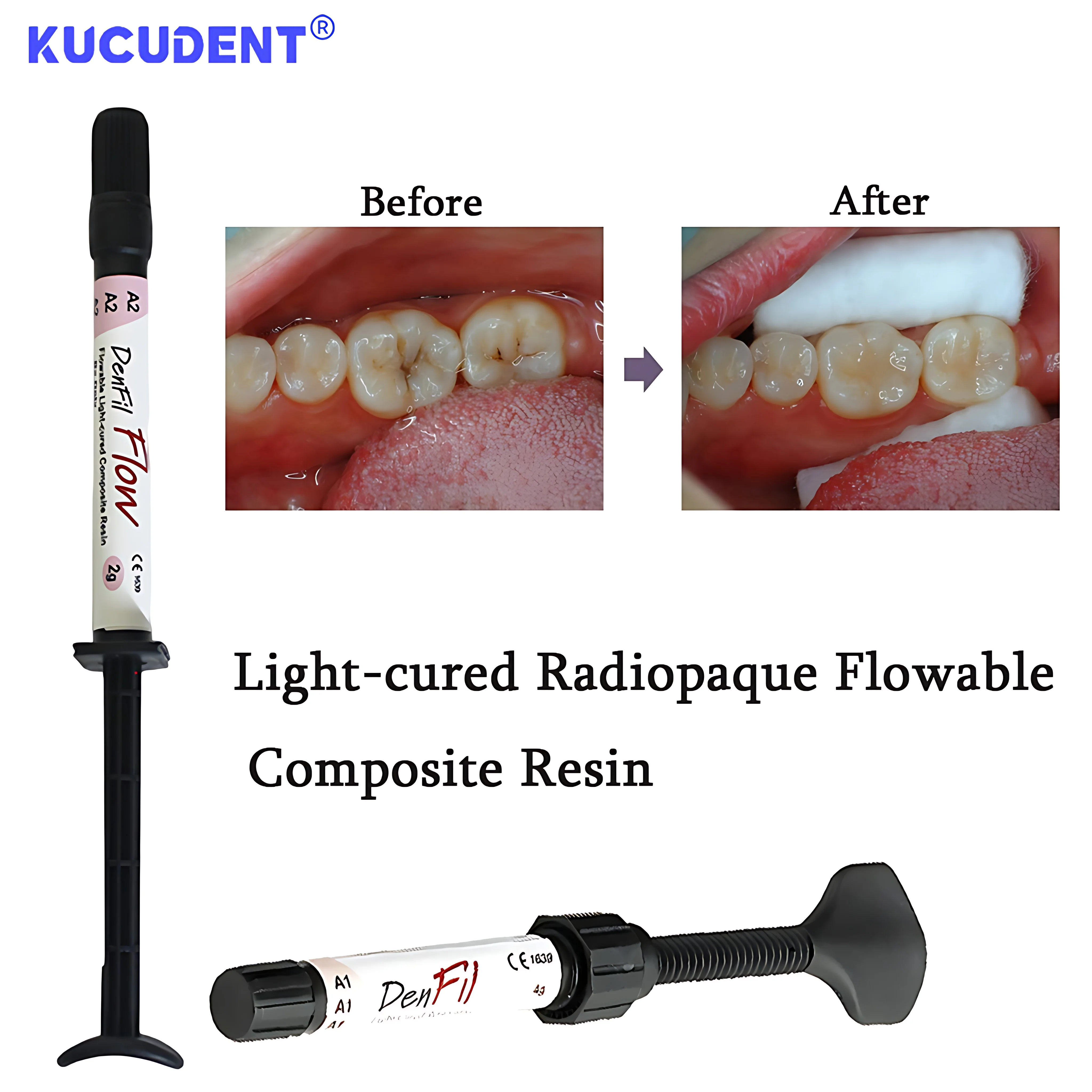 DenFil Flow Resina Composta Fluxível Dental Fotopolimerizável Radiopaca - Relleno Dental Adesão Restauração de Coroa