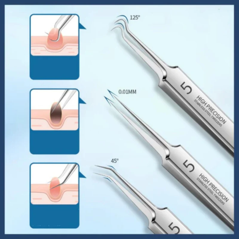 にきび除去ツール 8 個セット - ステンレススチールの傷とニキビ抽出ツール - すべての肌タイプ用スクイーザーセット