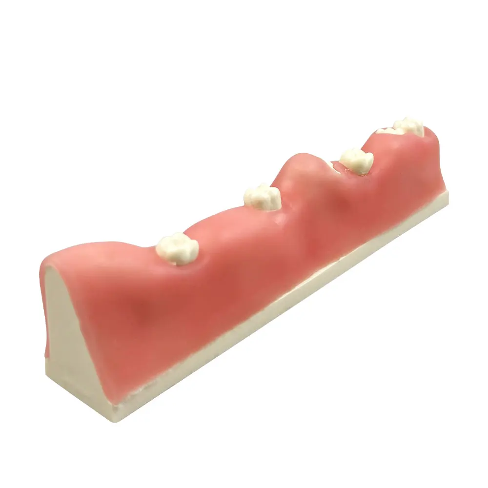 

Dental Obstructive Wisdom Teeth Extraction Model Oral Care Dental Model Teaching Dentistry Research Training Teaching Model