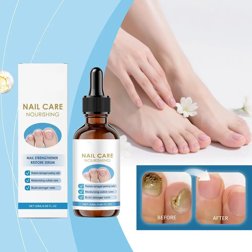 

20ml Nail Repairing Liquid Essence Hand Care Foot Fungal Removal Repair Serum Anti-Infective Paronychia Nail Polish Repair