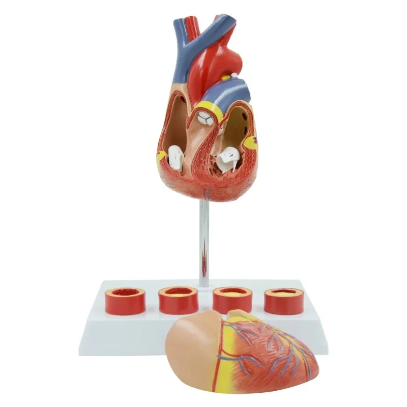 4 Stage Vascular Heart Anatomy Model Heart Blood Vessel Specimen Heart Structure School Medical