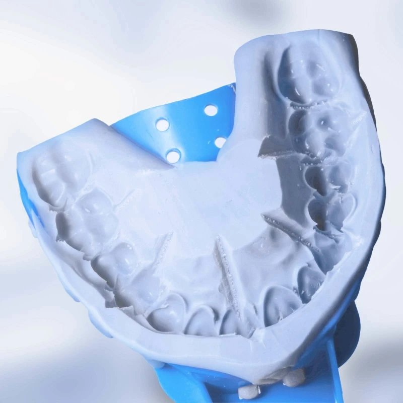 Dental para bandejas impresión 10 unids/set bandejas azules ABS desechables cumplen con diferentes envíos directos