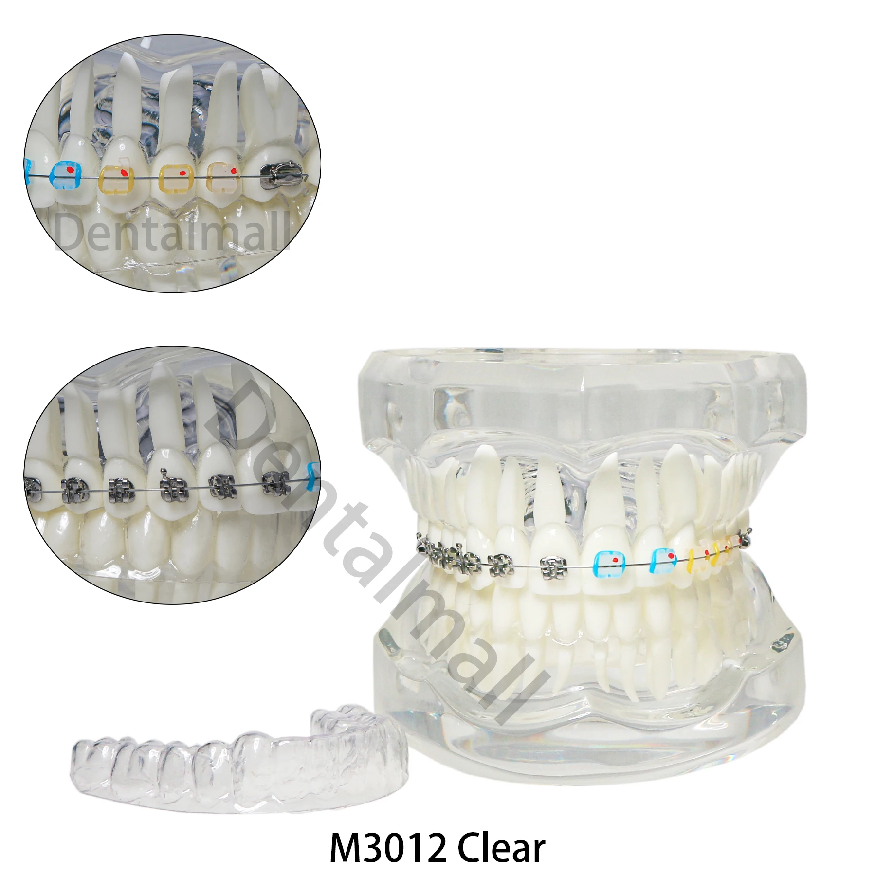 Dental Teeth Model Teaching Orthodontic with Retainer Metal Ceramic Bracket Demo M3012 Clear