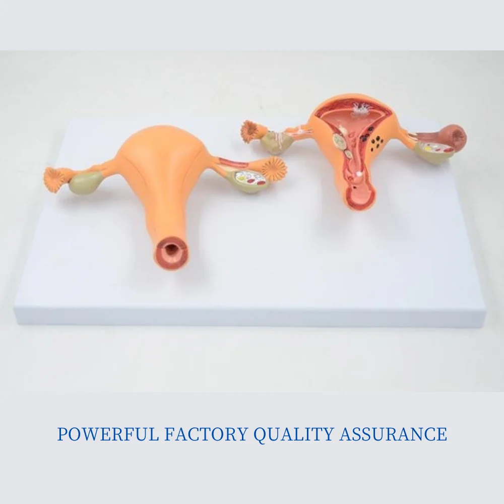 

Normal and Pathologic Uterus Comparison Model Human Anatomical Medical Skills Training Simulator Educational Assistance Equipmen