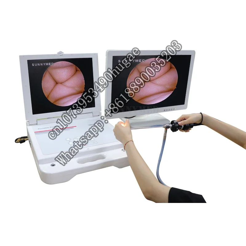 SY-PS045N all in one 17 inch CCD  system for gynecology/Urology/ENT