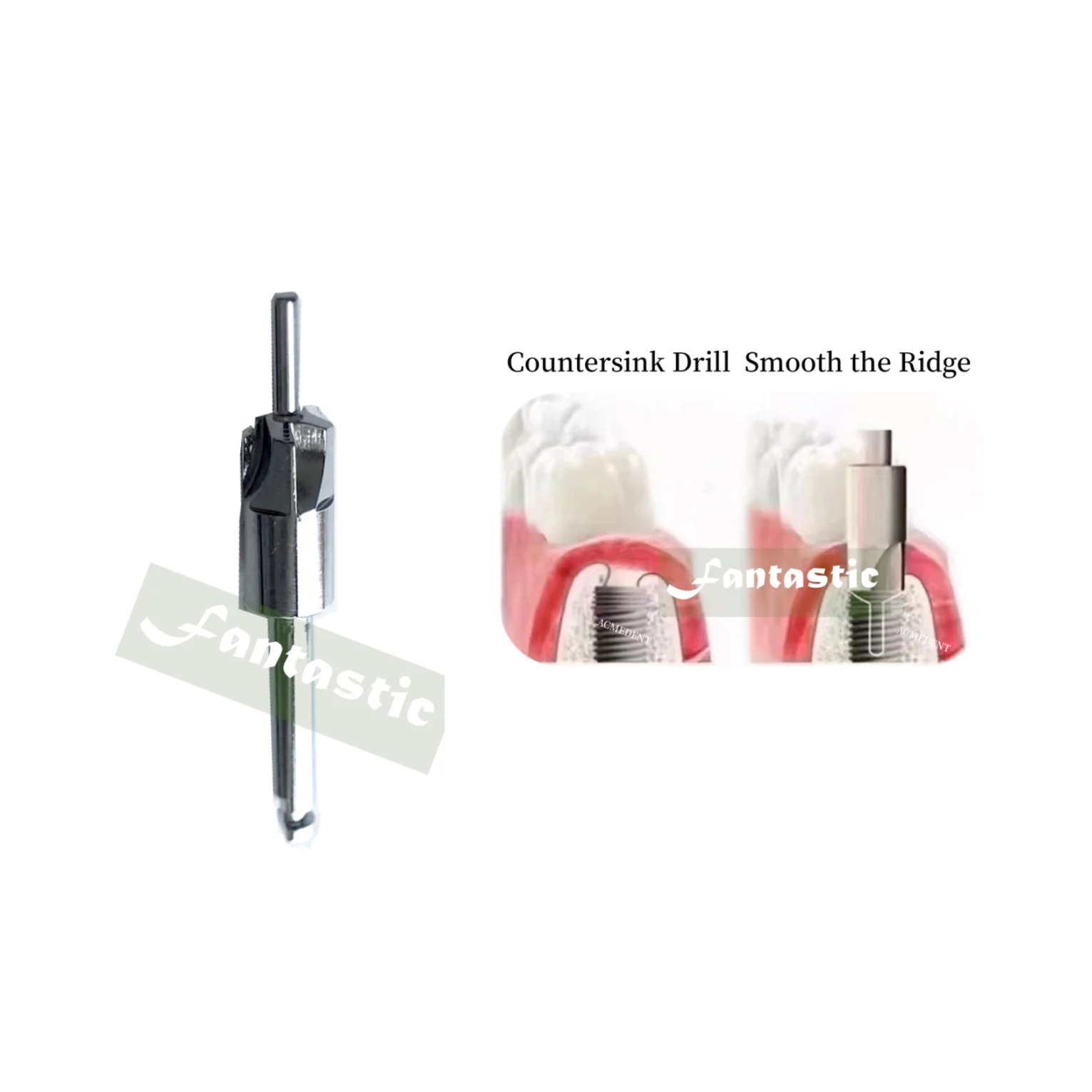 1~10 pieces Dental Countersunk Drills Bone Harvest Drill Abutment Open Hole Collector Graft