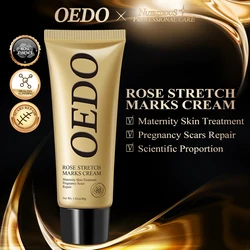 Rosa remover estrias creme anti rugas anti envelhecimento reparação da pele maternidade remover cicatrizes gravidez tratamento cuidados com a pele do corpo