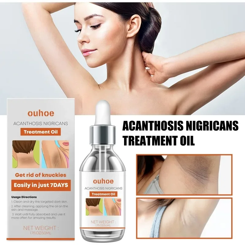 

Acanthosis nigricans essence oil repair armpit elbow Knee joints thigh inner whitening fade Dark spots Dull skin Treatment Serum