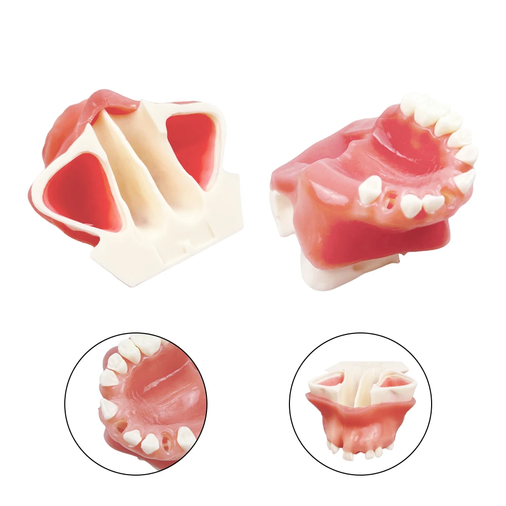 1 pz Impianto a bocca piena del seno massilare con modello di denti mancanti Modello di pratica didattica per studenti