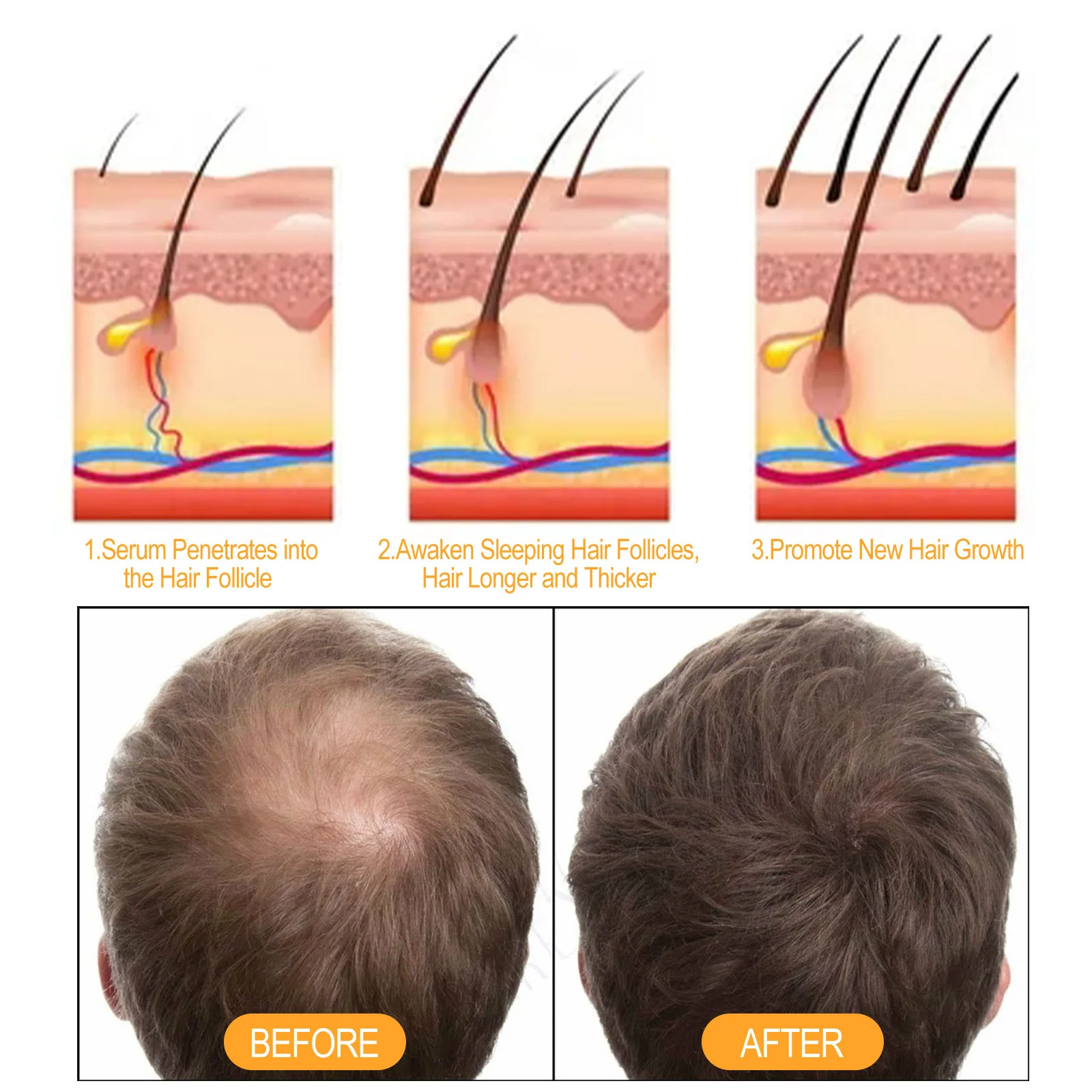 100ml Professional Hair Ginger Shampoo Hair Regrowth Dense Fast Thicker Hair Growth Shampoo Anti Hair Loss Product