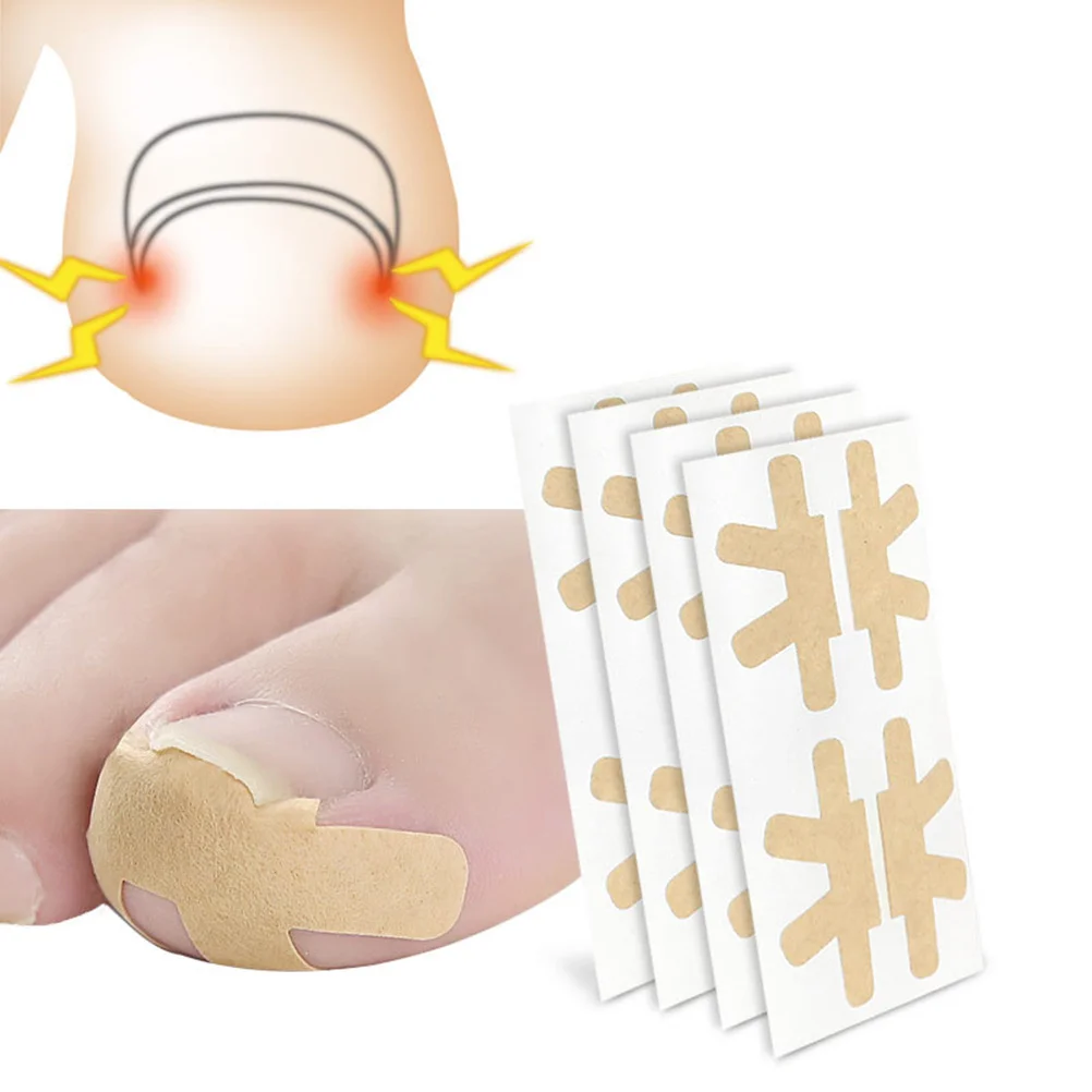 3Sheets Ingrown Toenail Tape Toenails Brace Sticker Correction Patch Tool Corrector Pedicure Care Tool Aid Relief Pain