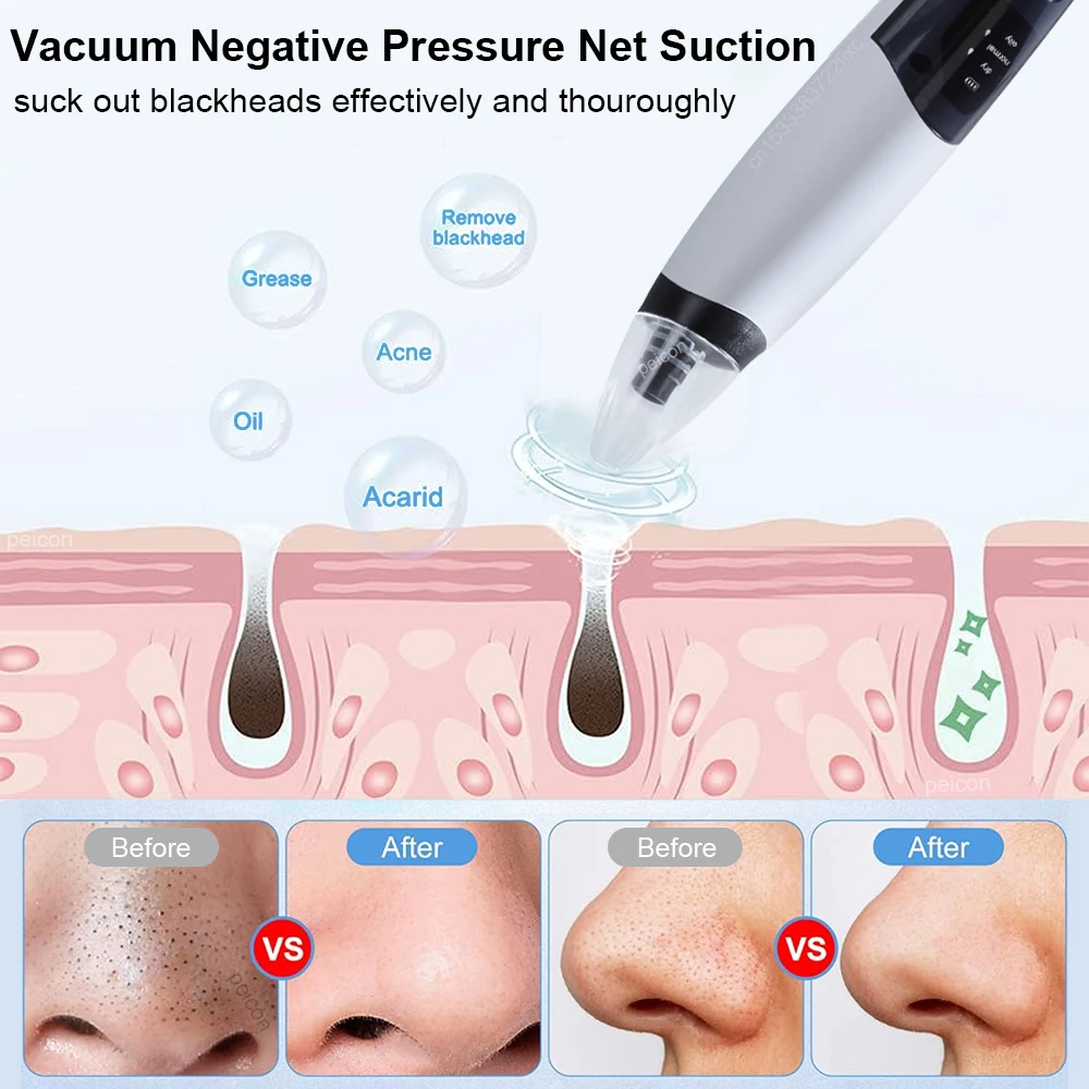 Electric Blackhead Remover Pore Vacuum Suction Cleaner Facial Spots Pimple Cleaning Machine Skin Care Black Head Acne Remover