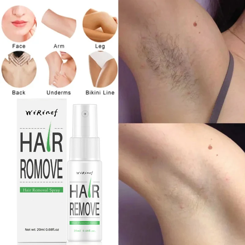 Permanent Hair Removal Spray Fast Hair Growth Inhibition Remove Armpit Legs Arms Painless Depilatory Nourishing Repair Body Care