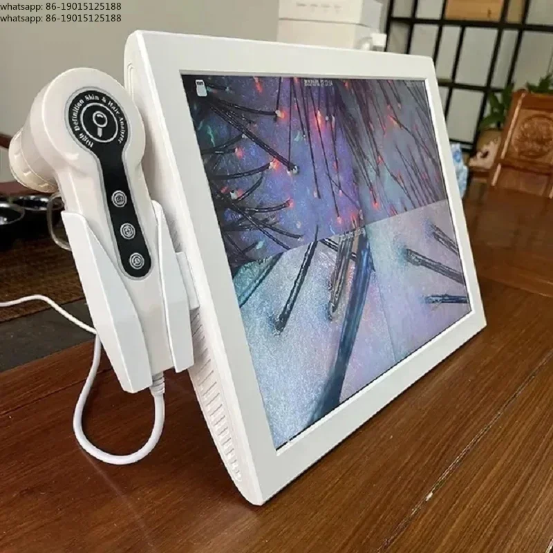 Professional Hd Hair Follicles Scalp Scanner Detector Hair Analyzer / Skin And Scalp Hair Analysis Machine