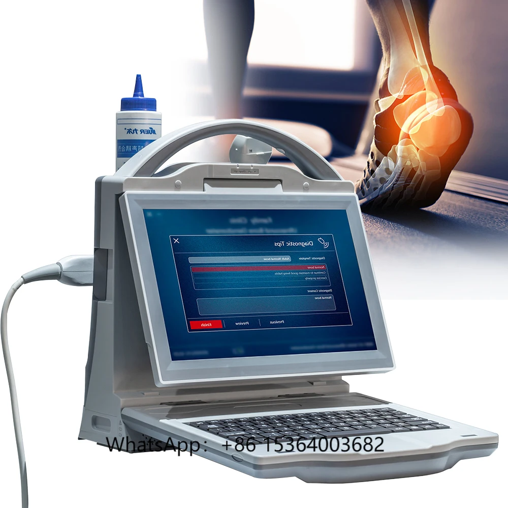 

Medical Diagnostic Ultrasonic Bone Density Scanner Ultrasound Bone Densitometer