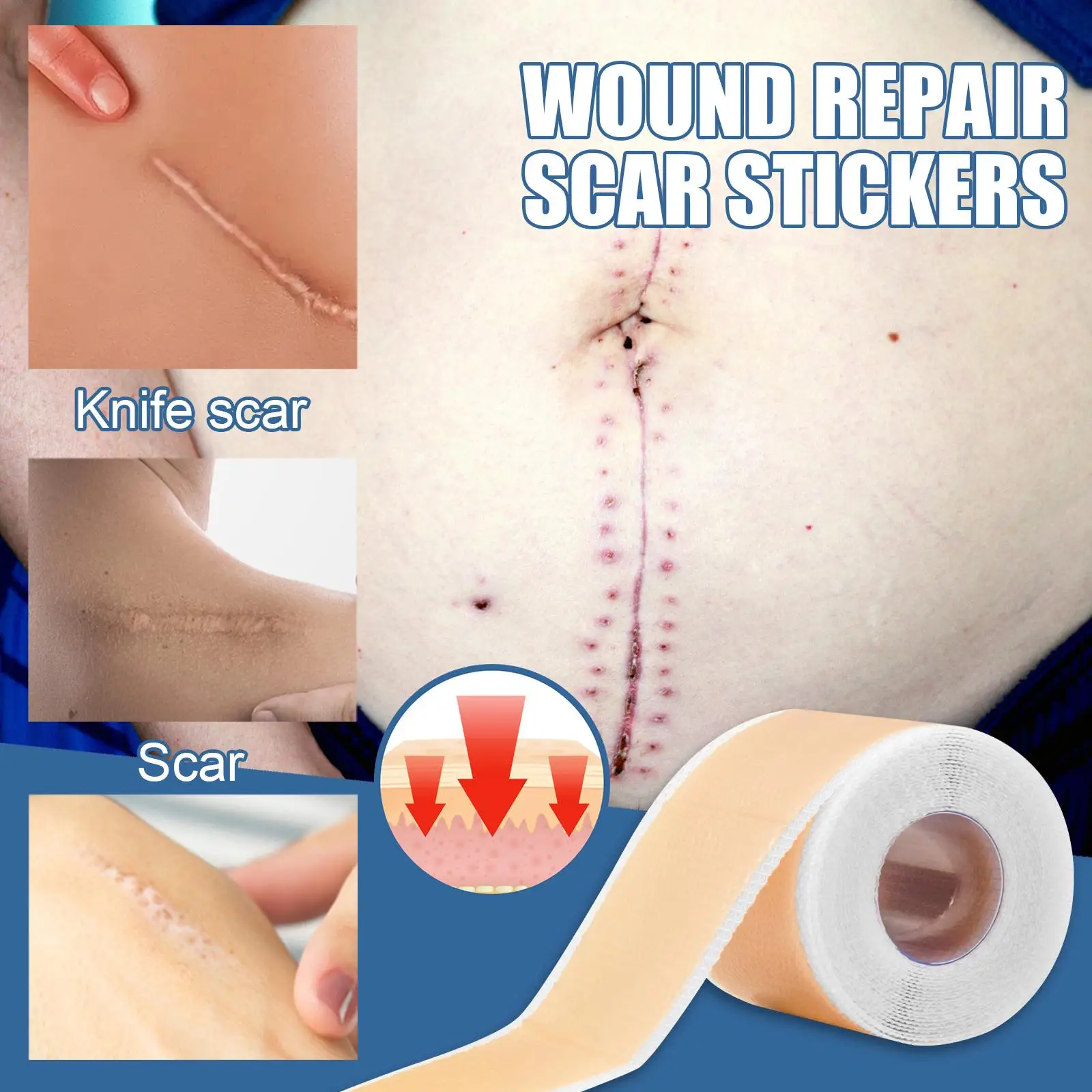 Silicone Scar Sheets Patch Painless Scar Repair Tape Roll Effective Scar Removal Strips For C-Section Keloid Surgery Burn Acne