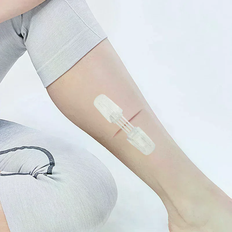 Zipper Band-aid Painless Wound Closure Device Suture-free Wound Dressing Patches Zip Suture Reducer Band Aid