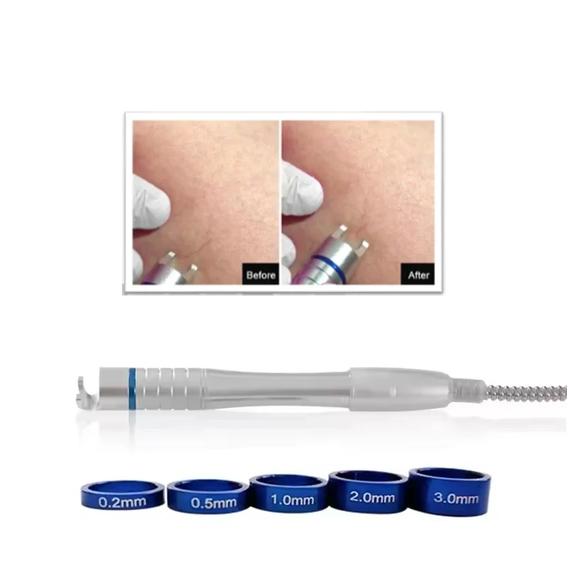 

980nm Diode Laser Vascular Vein Removal Handle for Blood Vessels Machine Spare Parts Spider Vein Remove Probe Skin Care Tool